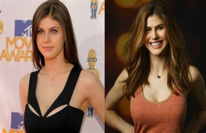 Did Alexandra Daddario Undergo a Breast Reduction?