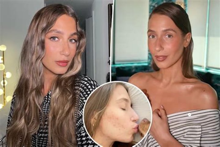 Did Amanda Batula Get A Nose Job? Before And After Photos Explored
