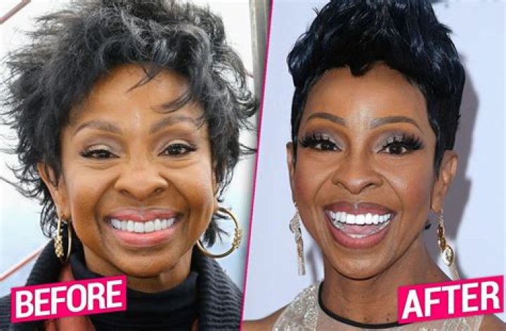 Gladys Knight Denies Plastic Surgery, Credits Her Genes For Looking Young!