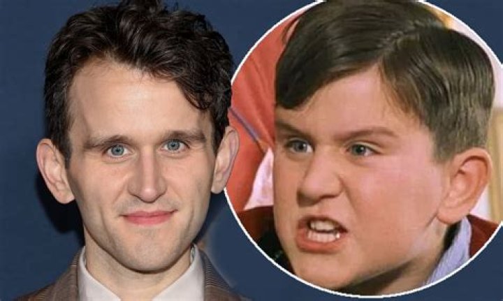 Has Harry Melling Had His Teeth fixed? The Pale Blue Eye Cast Before And After Photo
