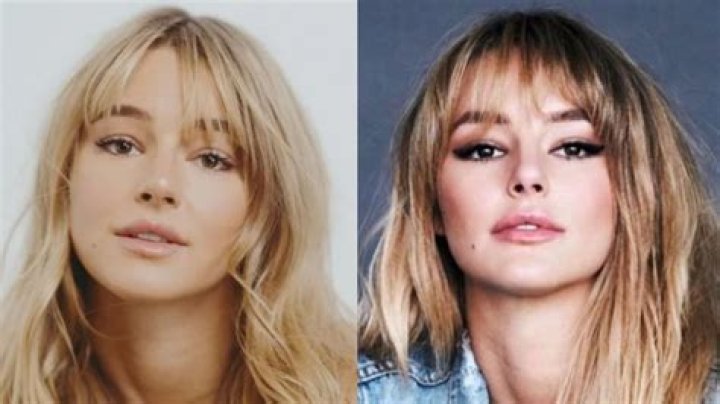 Hassie Harrison’s Plastic Surgery: Know Everything About Her Transformation!