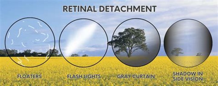 How Did Benjamin Hall Lose Sight In One Eye? Here Is What Happened To Him