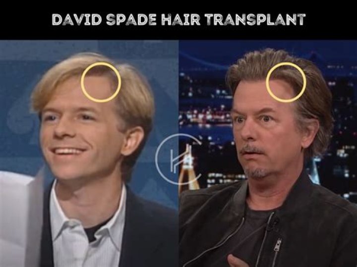 Is Actor David Spade Bald, Fans Believes The Actor Wears A Wig – Let’s Find Out