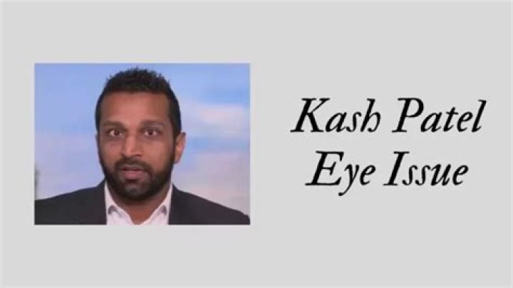 Is Kash Patel Blind In One Eye And Does He Have A Glass Eye? Condition Explained