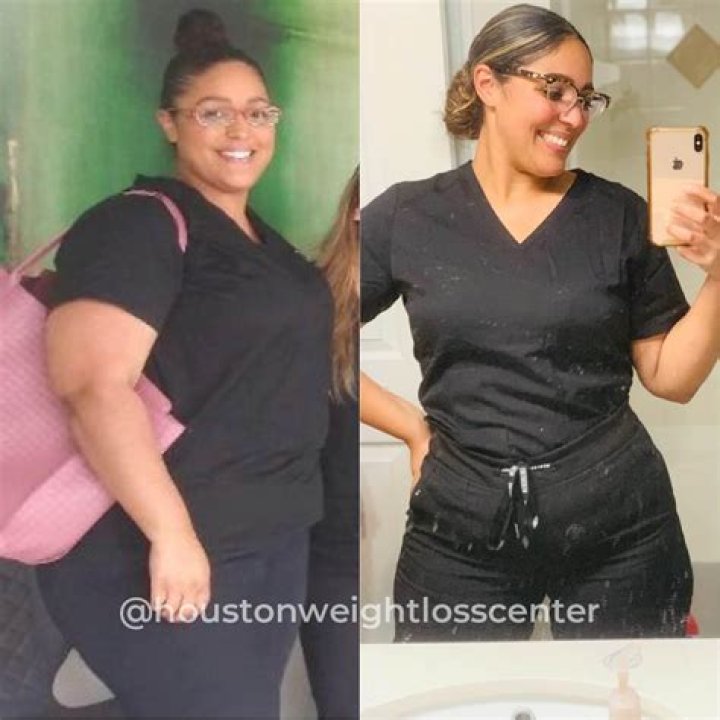 Jennifer Franciotti Weight Loss- Before & After Photos Exposed
