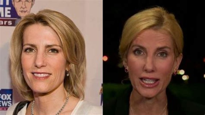 Laura Ingraham’s Plastic Surgery: Botox, Facelift, and Lip Augmentation!