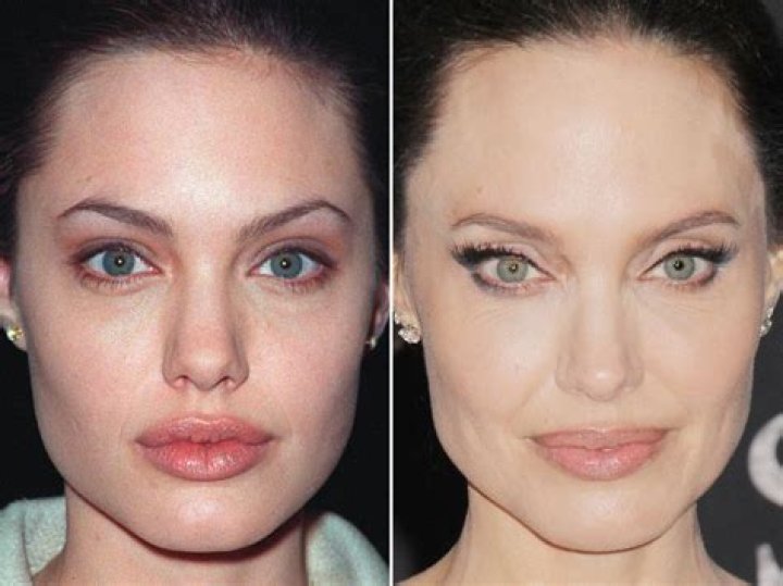 Perfect Match: Did Francesca Farago Get Her Lips Done? Plastic Surgery Before And After