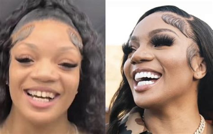 RHOC: Nicole Weiss Before Surgery – How Did She Look? Young Photos