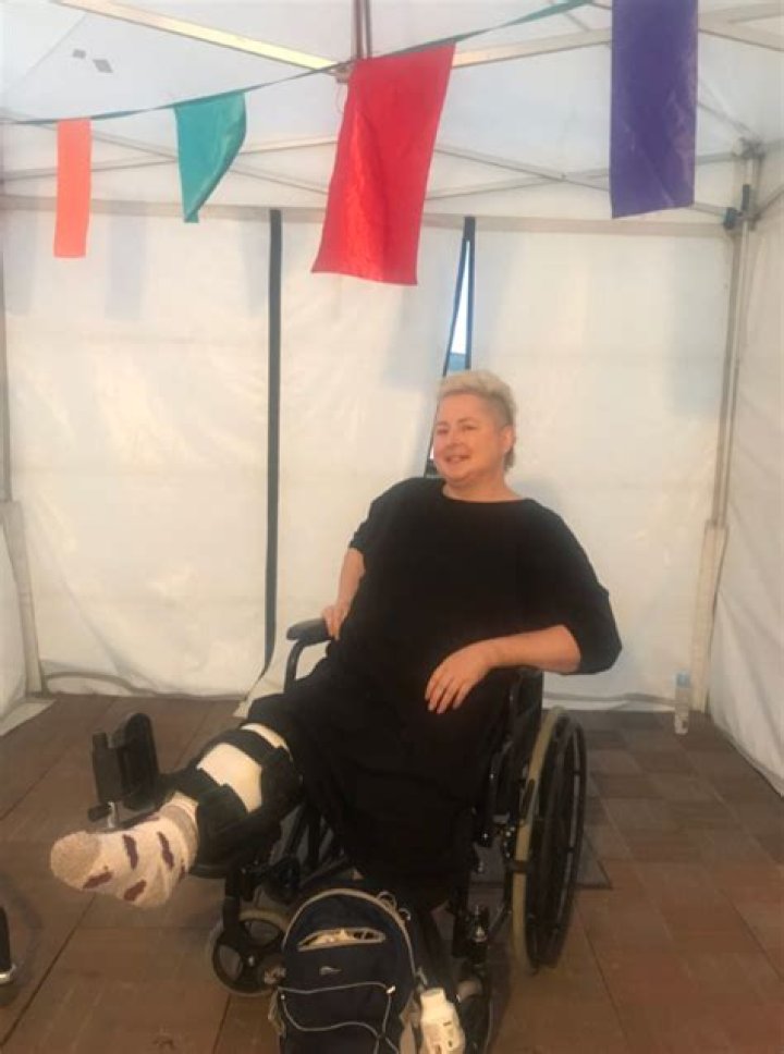 Was Siobhan McSweeney in An Accident? Actress Teeth And Broken Leg Making Fans Worry