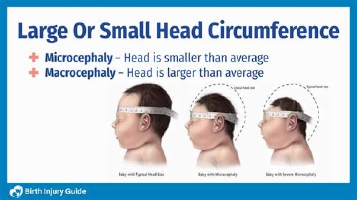 What is normal head circumference for a 4 month old